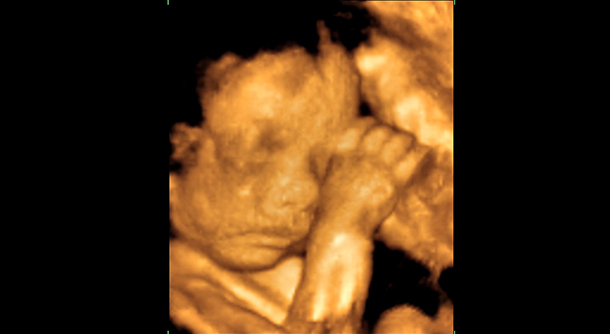 Ultrasound image of a baby